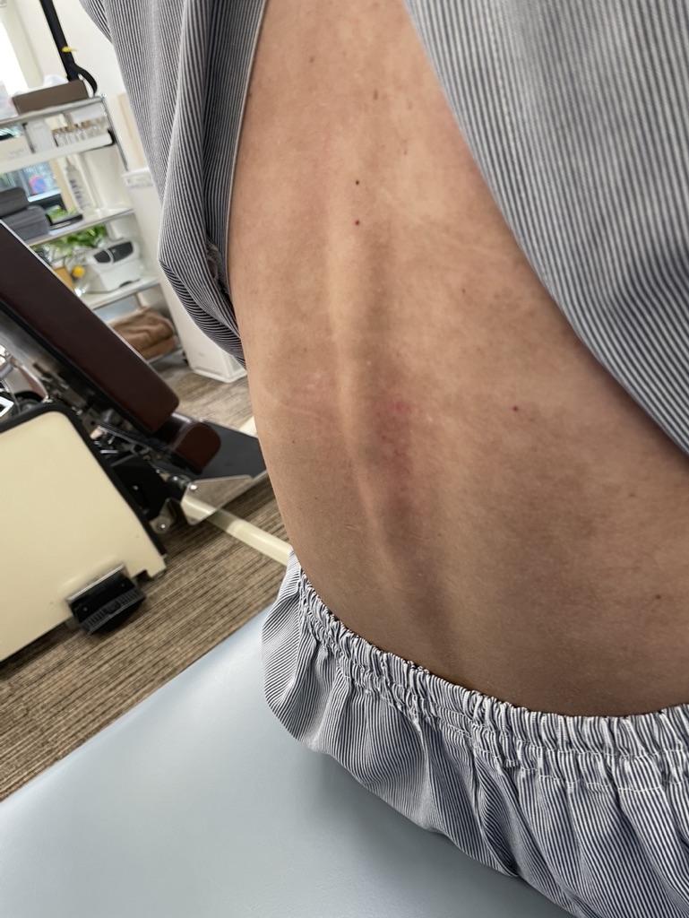 背中の姿勢評価　座り方の歴史