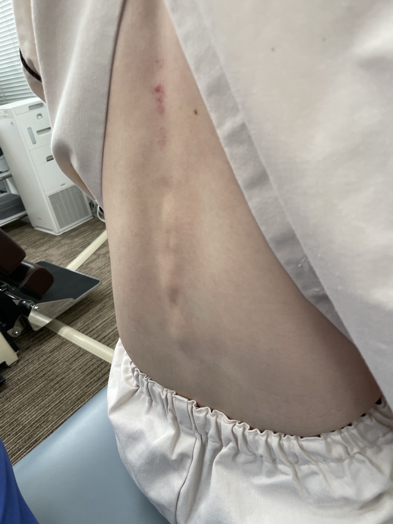 背中の姿勢評価　座り方の歴史